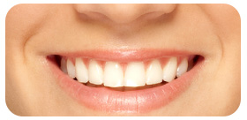 クリーニングの写真